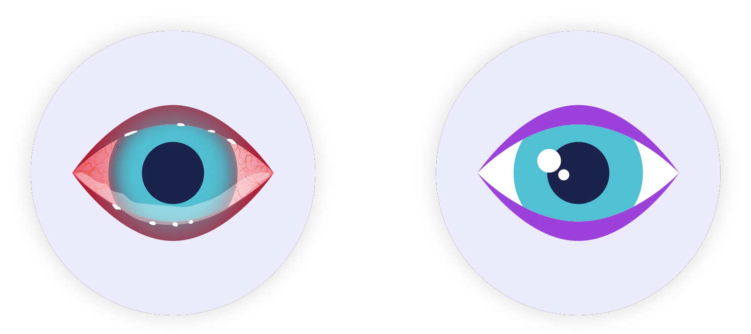 Eye vision  saver  app